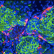 Insulin-producing pancreatic beta cells. Image: NIH